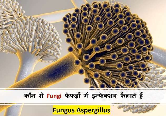 lungs-fungus-in-infection